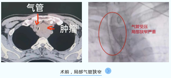 捕获.PNG